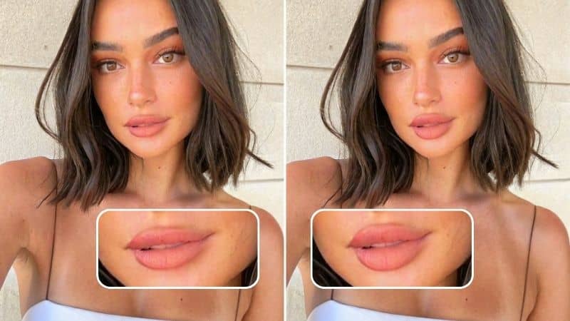 Cover photo - Find Out What Lip Shape Suits You Use A Lip Filler Simulator