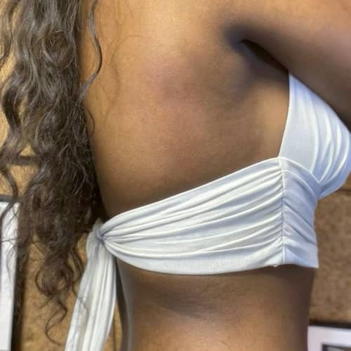 remove tattoo - example tattoo on the back after